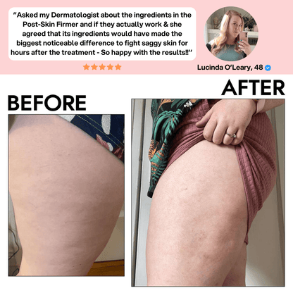 SheVitality™ Post-Skin Firmer - BUY 1 GET 2 FREE + ANTI COLLAGEN MASK