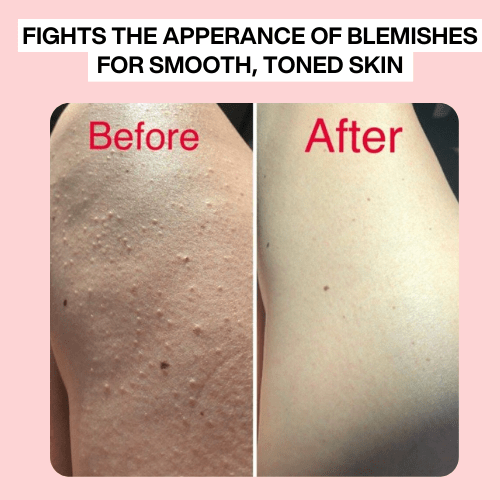 K-Vitality Cream™ (Anti-Spider Veins, Bruising & Dark Spots)