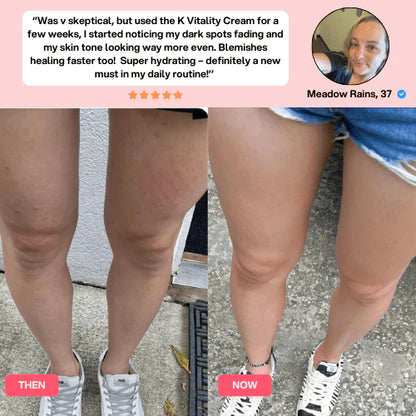 DrMelaxin™  Cellulite Relief Kit