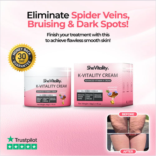 K-Vitality Cream™ (Anti-Spider Veins, Bruising & Dark Spots)