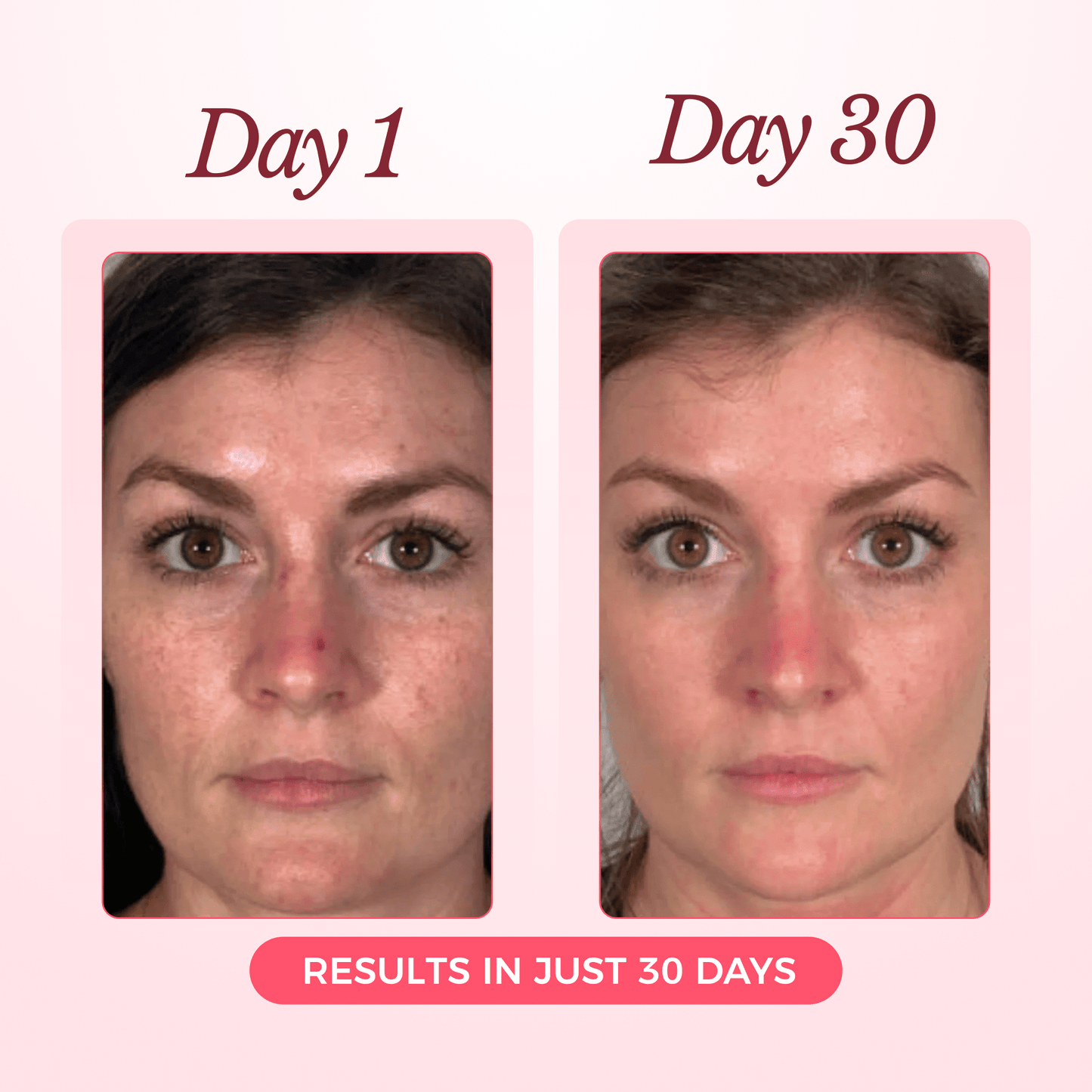 Luxury Collagen Glow Up Mask 2.0 (Spa-Level Results)