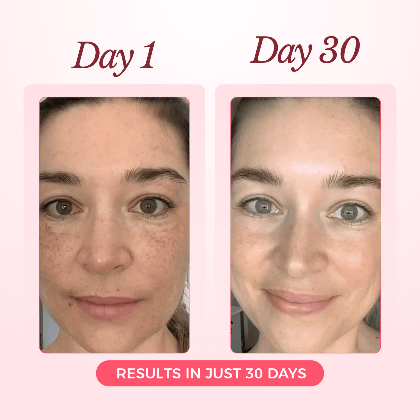 Collagen Glow Up Mask 2.0 - 90 Day Supply (8 Masks + 4 FREE!)