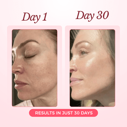 Luxury Collagen Glow Up Mask 2.0 (Spa-Level Results)